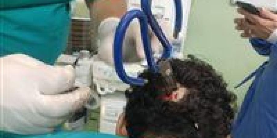 واقعة نادرة.. جراحة دقيقة تنقذ مريضًا أصيب بمقص في الجمجمة ببنها - زاجل الإخباري